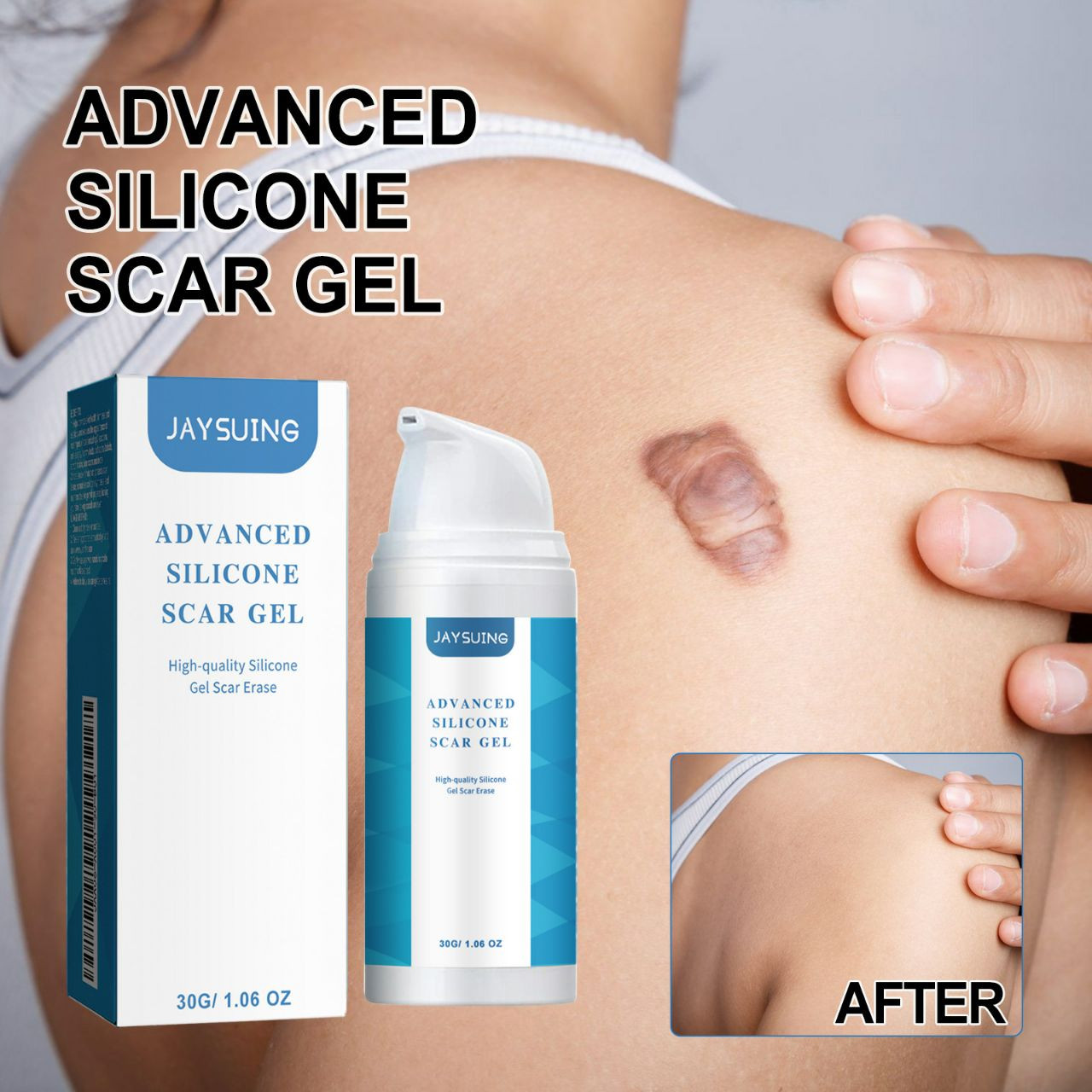 Gel réparateur de  cicatrices de jayage ont des fade cicatrices de grossesse cicatrices de chirurgie acné gel de soins de la peau lisse 30g